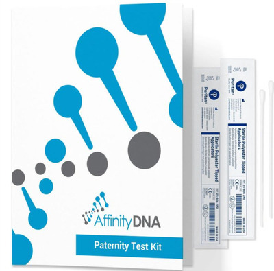 affinity-dna-test-del-dna-per-la-paternità